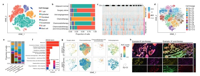 食管鳞癌新辅助化疗